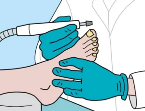 Spirularin® N Nagelserum voor nagels die gevoelig zijn voor schimmelinfecties.